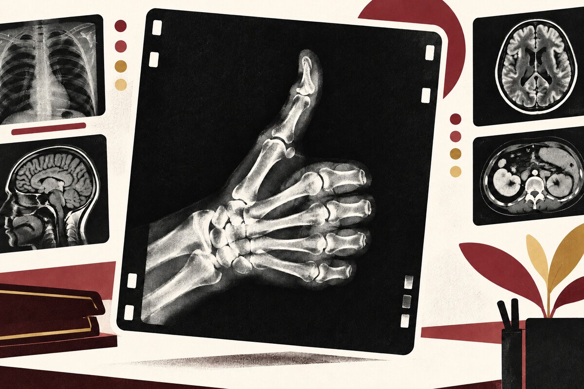 Illustration of a radiograph hand giving a thumbs-up beside scan images